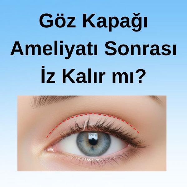 Göz Kapağı Ameliyatı Sonrası İz Kalır mı
